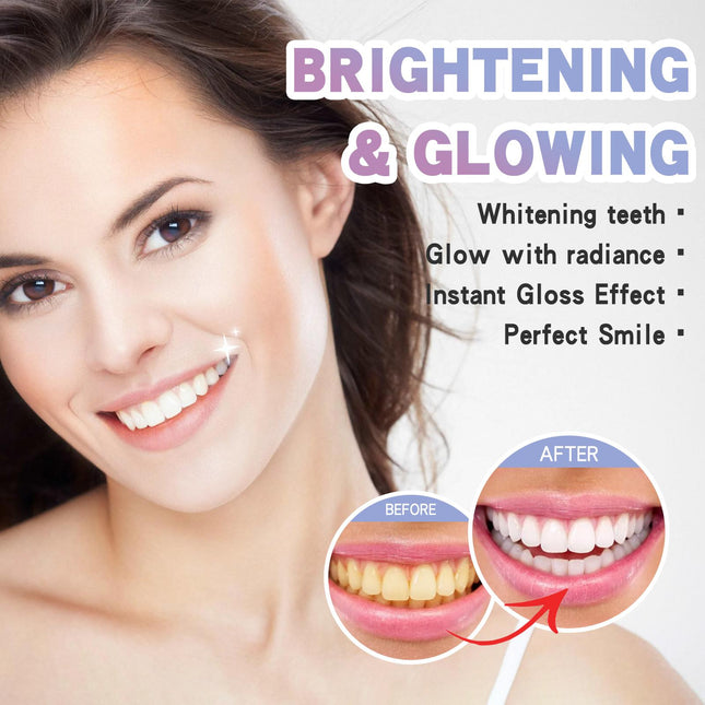 Overnight Bright™ Teeth Whitening Pen – Precision Stain Remover for a Whiter Smile