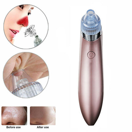 ClearPore™ Professional Blackhead Vacuum – 3-Level Suction Pore Cleaner & Acne Remover