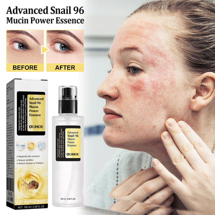 Snail Mucin Repair Serum – Ultra Hydrating & Skin Regenerating Essence