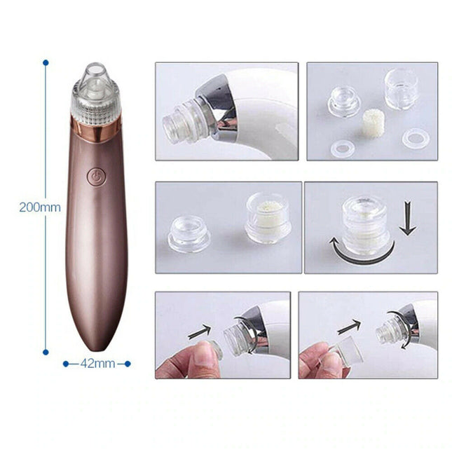 ClearPore™ Professional Blackhead Vacuum – 3-Level Suction Pore Cleaner & Acne Remover