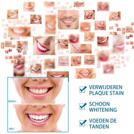 JaySuing™ Instant Teeth Whitening Pen – Professional Stain Eraser for Coffee & Tobacco