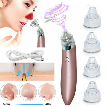 ClearPore™ Professional Blackhead Vacuum – 3-Level Suction Pore Cleaner & Acne Remover