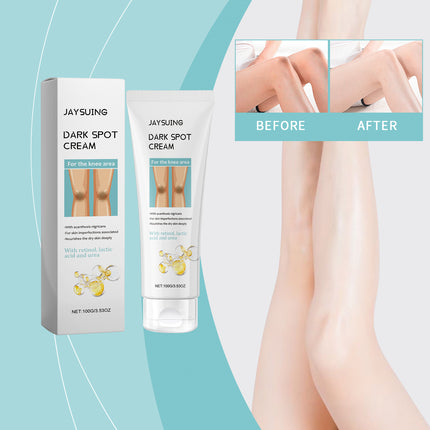 Retinol & Lactic Acid Knee Brightening Cream – Deeply Moisturizing & Smoothing Formula for Dry, Rough Skin