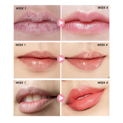 Smooth & Soft Lip Scrub – Anti-Wrinkle & Deep Moisturizing Treatment