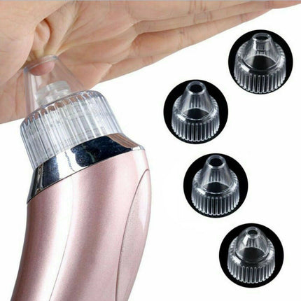 ClearPore™ Professional Blackhead Vacuum – 3-Level Suction Pore Cleaner & Acne Remover