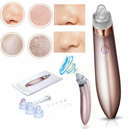 ClearPore™ Professional Blackhead Vacuum – 3-Level Suction Pore Cleaner & Acne Remover